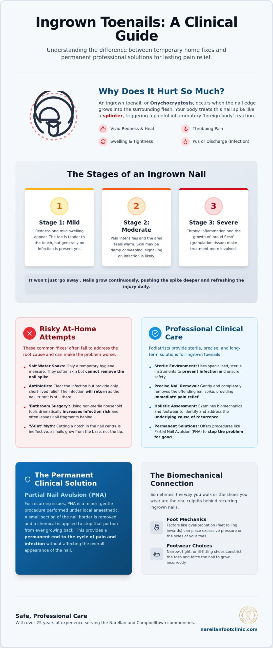 Ingrown Toenail Treatment: A Comparison of Home Care vs. Professional Podiatry