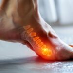 Arch Pain Treatment: A Professional Guide to Finding Lasting Relief