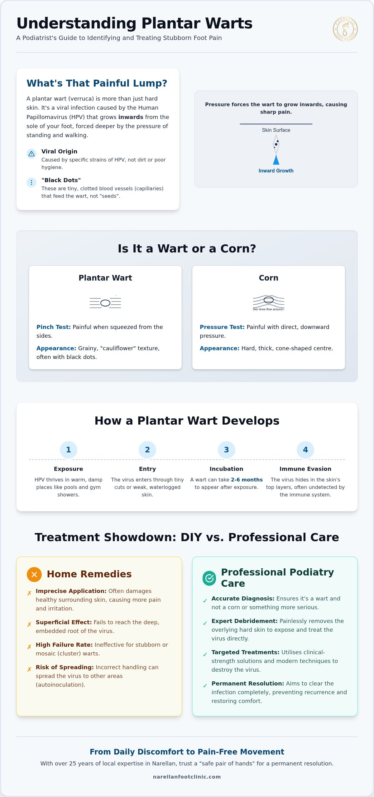 Plantar Wart Treatment: Professional Options for Lasting Relief in Narellan